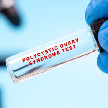 Le SOPK devient le syndrome métabolique ovarien polyendocrinien