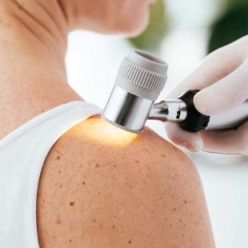Un tatouage intelligent pour détecter les mélanomes