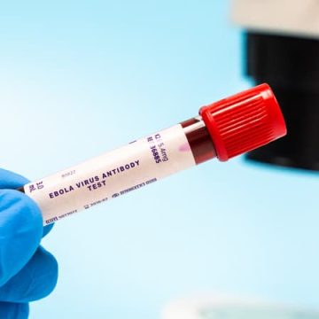 Recommandations de l’OMS pour l’épidémie d’Ebola en RDC