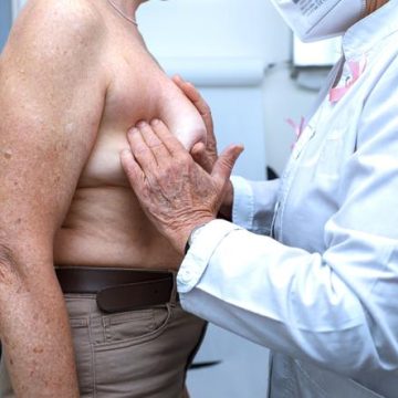 Lien entre alimentation bio et réduction du risque de cancer du sein