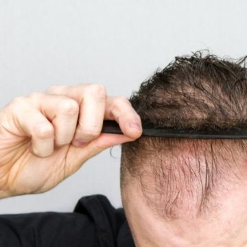 Une racine ancestrale pourrait freiner la chute de cheveux