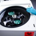 Des résultats prometteurs pour le traitement du mélanome par Moderna et Merck
