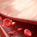 Comprendre le cholestérol et ses implications pour la santé cardiaque