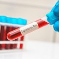Recrudescence de légionellose en Savoie : deux décès et 41 cas recensés
