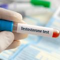 Effets de la Testostérone chez les Femmes : Analyse des Réseaux Sociaux