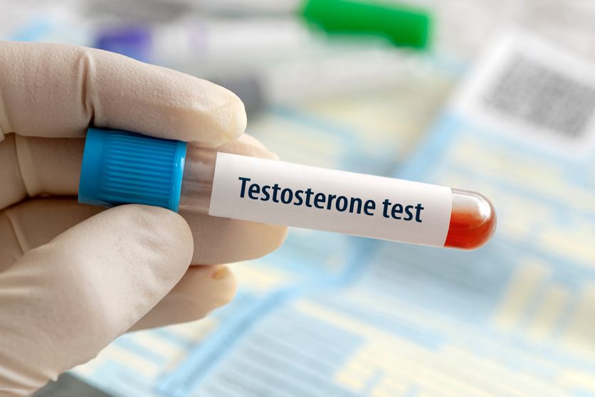 Testosterone hormone test result with blood sample in test tube on doctor hand in medical lab a blue laboratory background. Effets de la Testostérone chez les Femmes : Analyse des Réseaux Sociaux