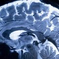 Une nouvelle approche pour comprendre le cerveau humain