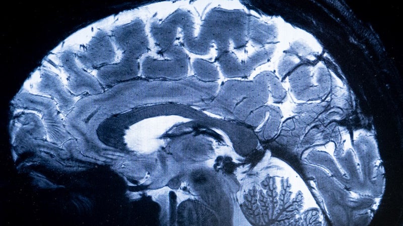 07d1c140-bf1d-46a5-a35b-ecc839137b53 Une nouvelle approche pour comprendre le cerveau humain