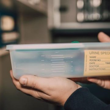 0a08c75f-b46d-480e-bf36-d1f6610be928 Nouveaux Tests Urinaires Pour Détecter le Cancer de la Vessie