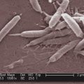 L&rsquo;impact des infections sur le cancer et les stratégies de prévention