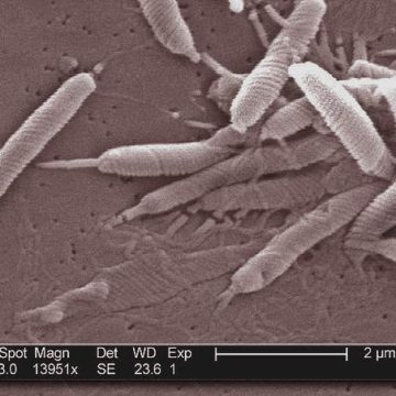 L&rsquo;impact des infections sur le cancer et les stratégies de prévention