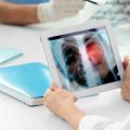 Signes d&rsquo;alerte pour la santé pulmonaire
