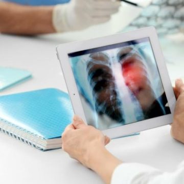326571e9-e5ff-4839-a27d-f19422de15ef Signes d’alerte pour la santé pulmonaire