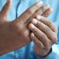 Comprendre le syndrome du canal carpien en France