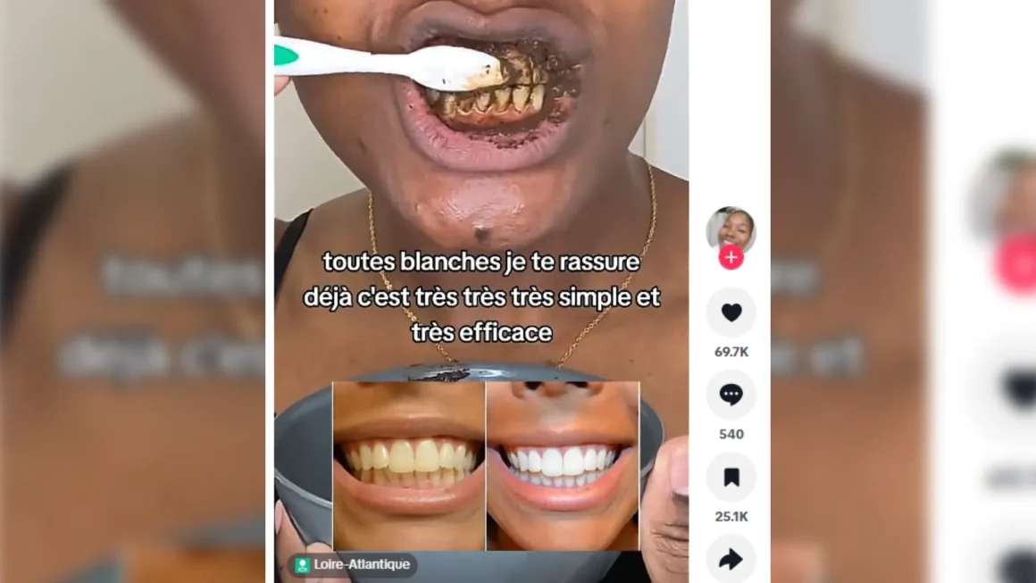 Attention aux vidéos pour blanchir les dents