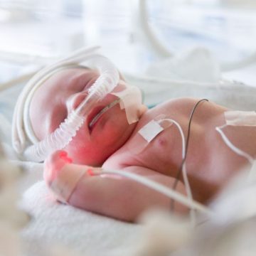 Le suivi des enfants prématurés après une décennie