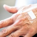 La cicatrisation lente chez les seniors : Comprendre le phénomène