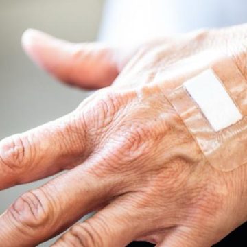 43b1fa3d-57c9-4bb6-83f0-a7e06307cf6d La cicatrisation lente chez les seniors : Comprendre le phénomène